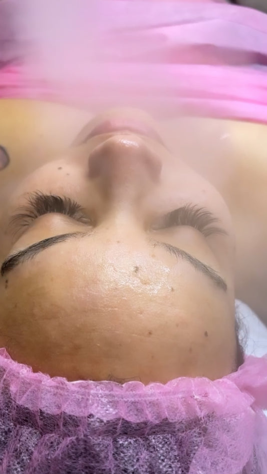 Hydrofacial